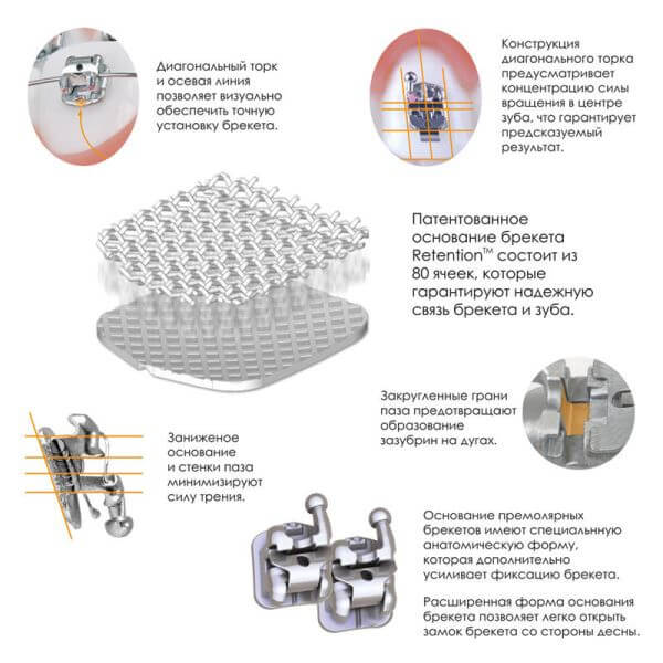Отличительные особенности брекетов Empower