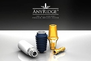 Особенности имплантов Anyridge