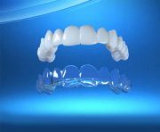 Прозрачная каппа Invisalign