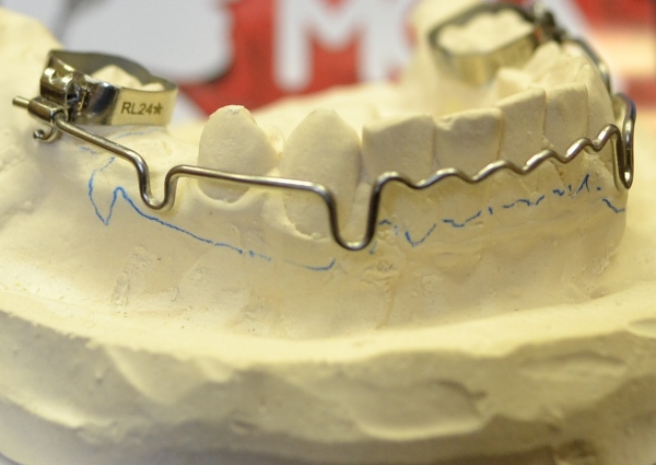 Mini master производства american orthodontics сша