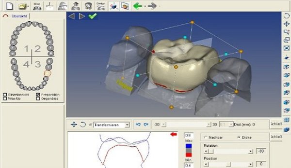 Использование Cad Cam системы в стоматологии