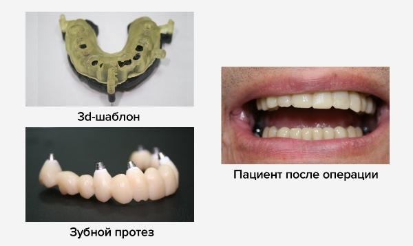 Преимущества методики