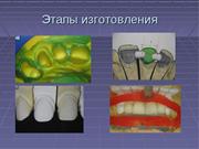 Изготовление полукоронок