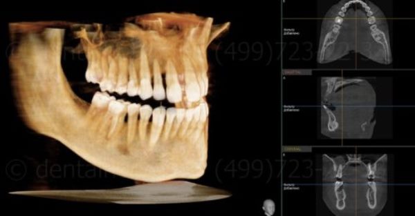 Параклинические методы диагностики в ортодонтии