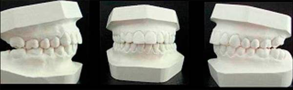 Диагностика зубочелюстных аномалий в ортодонтии