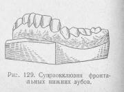 Опасности супраокклюзии