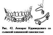 Аппарат Курляндского отзывы