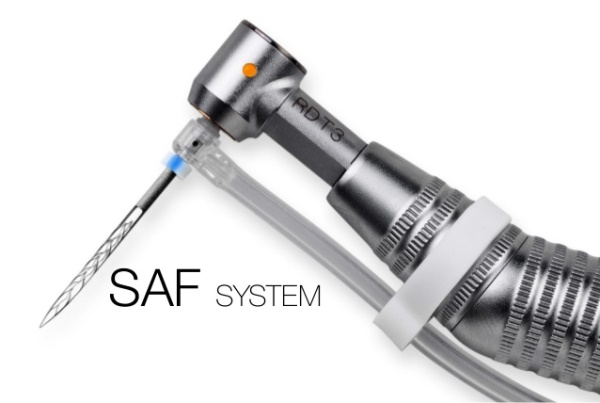 Преимущества использования SAF системы в эндодонтии