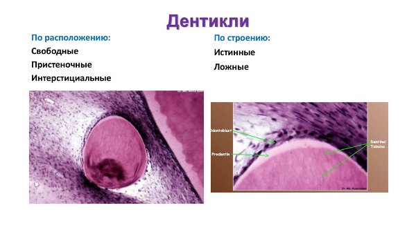 Дентикли гистология