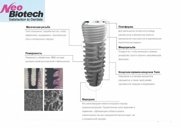 Имплантат neobiotech отзывы