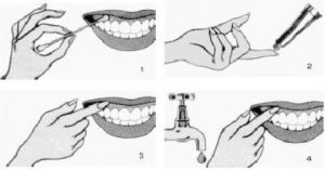 как правильно пользоваться дентальной адгезивной пастой
