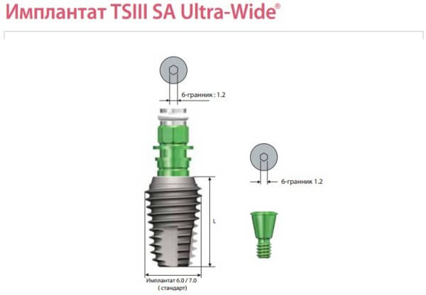 Корейский имплант. Импланты Осстем Корея. Корейские импланты зубов Osstem. Импланты Осстем ТС 3. Корейский имплант зуба Osstem.