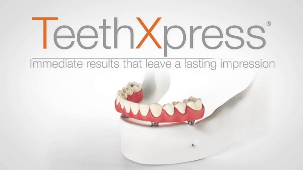 Плюсы и минусы имплантации Teethxpress