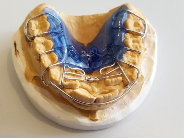 Как работает Биоблок в ортодонтии